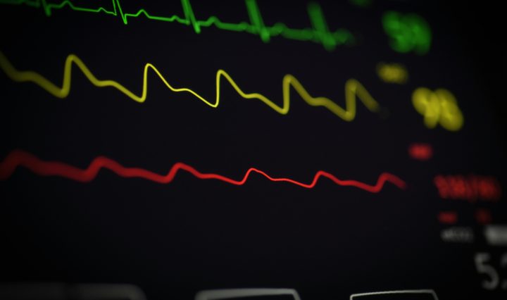 how to become electrocardiograph technician